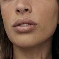 belonly Nude