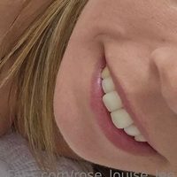 rose_louise_lee Nude